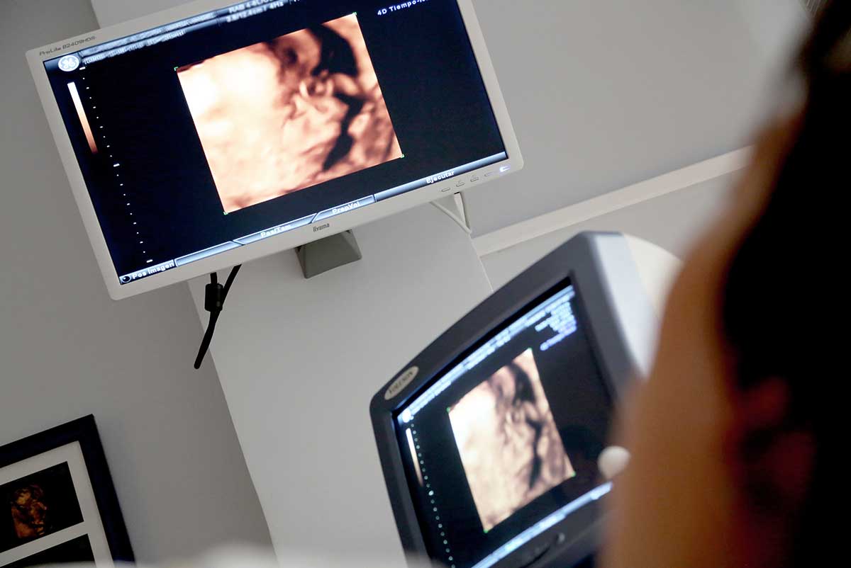 4-d-ultrazvuk-u-trudnoći