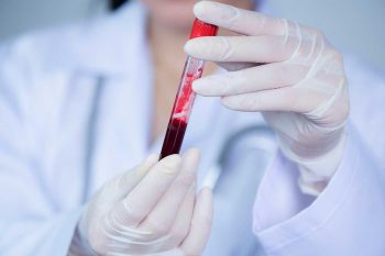 Laboratorija analiza krvi. Laborant u rukama drži epruvetu ispunjenu krvlju.