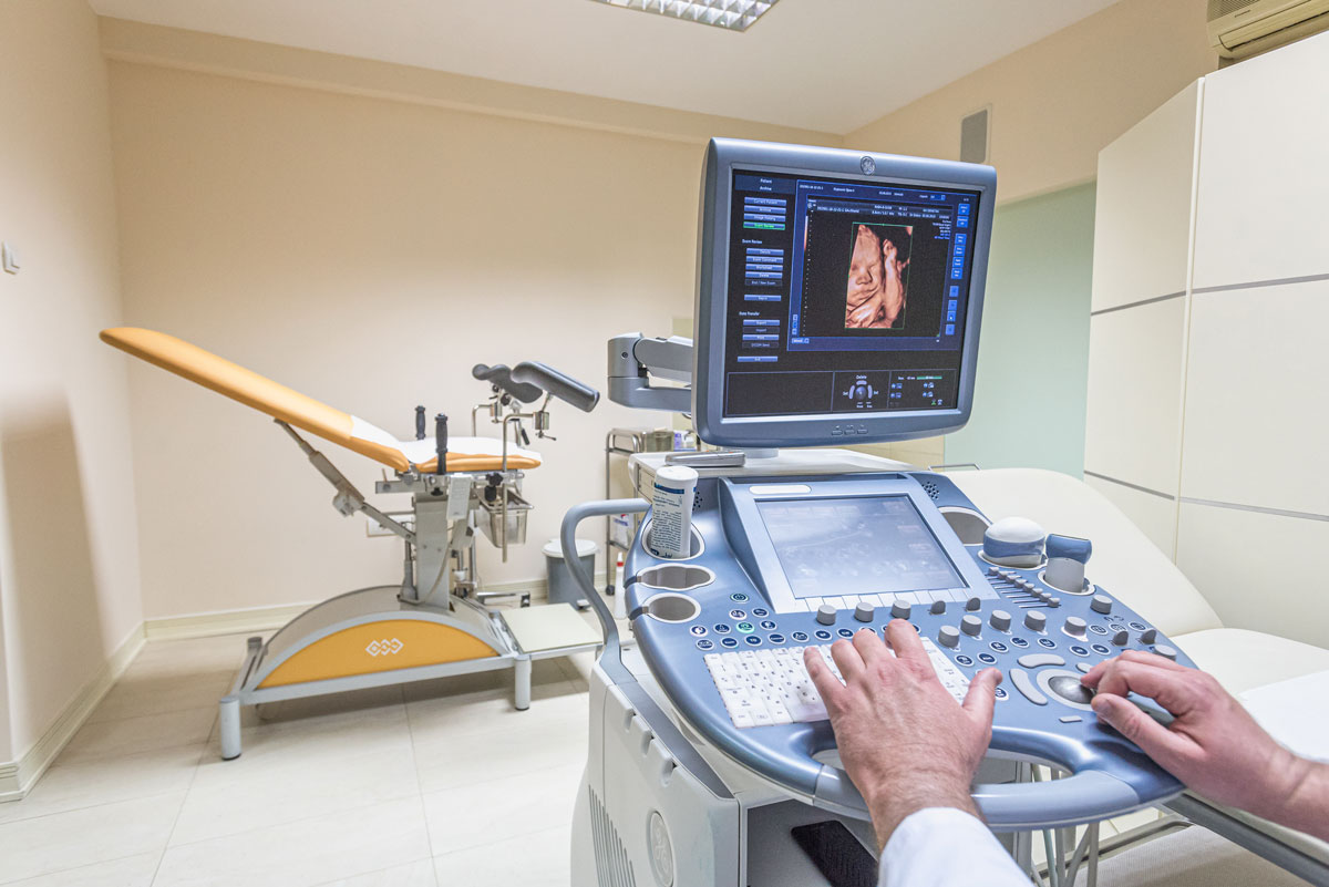 4d ultrazvuk aparat u Ginekologiji Tiršova
